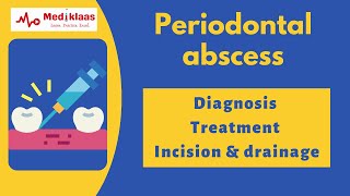 Periodontal abscess Part 2  Diagnosis and Treatment l Incision and drainage l Mediklaas [upl. by Sheffy743]