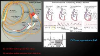 Hemodynamic Monitoring Part 1 [upl. by Frisse]