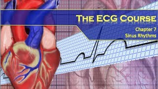 The ECG Course  Sinus Rhythms [upl. by Lorrimer]