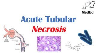 Acute Tubular Necrosis ATN  Symptoms Causes and Treatments [upl. by Pendergast675]