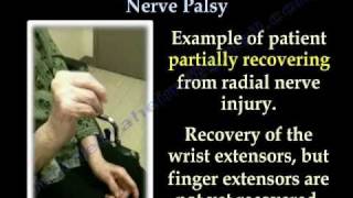 Radial Nerve Exercises for Relief and Recovery [upl. by Eetsud267]