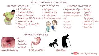 ULCÈRES GASTRIQUE ET DUODÉNAL  2è partie  Diagnostic [upl. by Ariahay576]