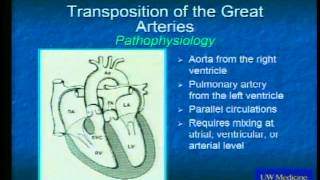 What Causes Congenital Heart Defects  Dr Emile Bacha [upl. by Stringer]