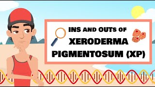 The Ins and Outs of XP Xeroderma pigmentosum [upl. by Einre21]