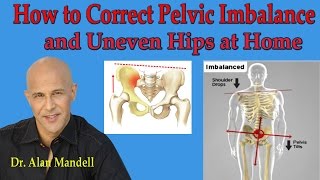 How To Correct Pelvic Imbalance and Uneven Hips at Home  Dr Mandell [upl. by Iolenta231]