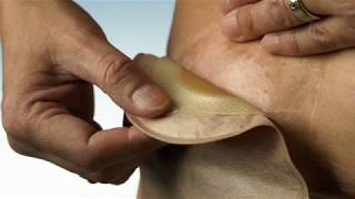 How to remove a 1piece ostomy pouch [upl. by Aneehsat]