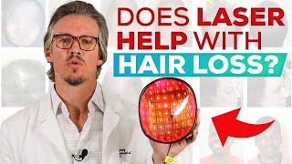 Laser Treatment For Hair Loss And Hair Regrowth Does It Work QampA [upl. by Euqinwahs]