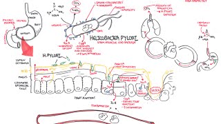 Microbiology  Helicobacter Pylori Ulcer [upl. by Brynna]