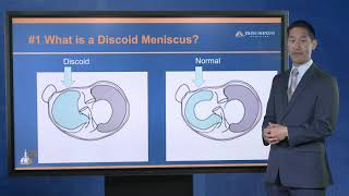 Discoid Meniscus Injuries  FAQ with Dr R Jay Lee [upl. by Any]