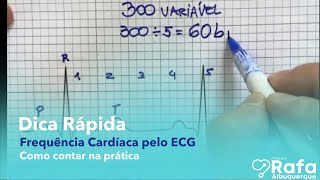 Frequência Cardíaca pelo ECG Eletrocardiograma ❤️ [upl. by Truelove]