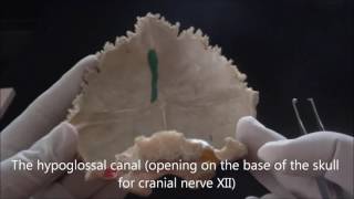 Bones of the skull  The occipital bone  Human Anatomy Video [upl. by Ras]