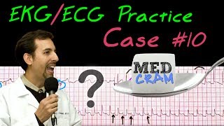 12 Lead ECG Practice Strip Interpretation  EKG Case 10 [upl. by Elisha]