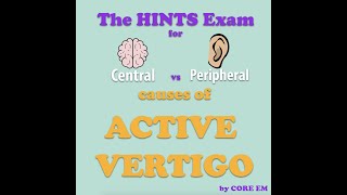 The HINTS Exam [upl. by Harraf]