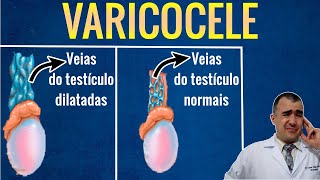 Quem precisa fazer a CIRURGIA DE VARICOCELE [upl. by Hagi370]