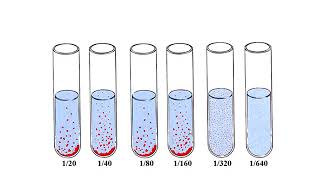 Widal test [upl. by Phillipp585]